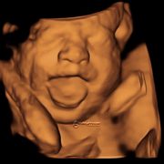 Baby Image Ultrasound