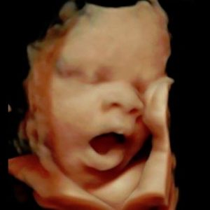 Baby Image Ultrasound