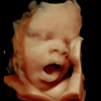 Best 3d, 4d/ 5d Ultrasound Services- Baby Image Ultrasound